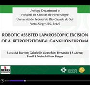 Robotic Assisted Laparoscopic Excision of a Retroperitoneal Ganglioneuroma