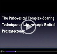 The pubovesical complex-sparing technique on laparoscopic radical prostatectomy