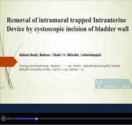 Removal of intramural trapped intrauterine device by cystoscopic incision of bladder wall