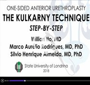 One-sided anterior Urethroplasty for panurethral stricture: step-by-step