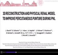 3D Reconstruction and physical renal model to improve percutaneous punture during PNL