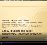 A new Surgical Technique: Transvesical Prostate Resection