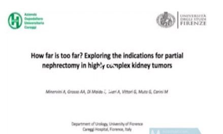 How far is too far? Exploring the indications for robotic partial nephrectomy in a highly complex kidney tumor