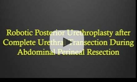 Robotic Posterior Urethroplasty after Complete Urethral Transection During Abdominal Perineal Resection