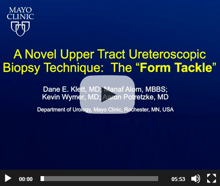 A novel upper tract ureteroscopic biopsy technique: the “form tackle”