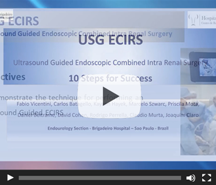Ultrasound guided endoscopic combined Intrarenal surgery – 10 steps for the success