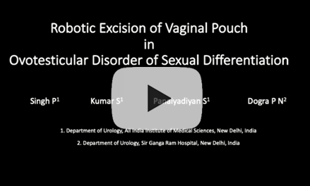 Robotic excision of vaginal pouch in ovotesticular disorder of sexual development
