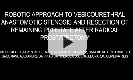 Robotic approach to vesicourethral anastomotic stenosis and resection of remaining prostate after radical prostatectomy