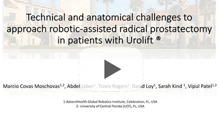 Technical and anatomical challenges to approach roboticassisted radical prostatectomy in patients with Urolift®