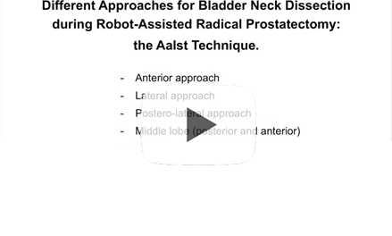 Different approaches for bladder neck dissection during robot-assisted radical prostatectomy: the Aalst technique