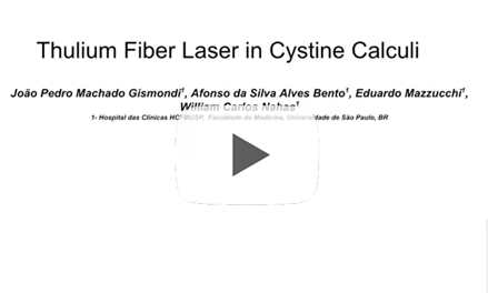 Thulium fiber laser in cystine calculi