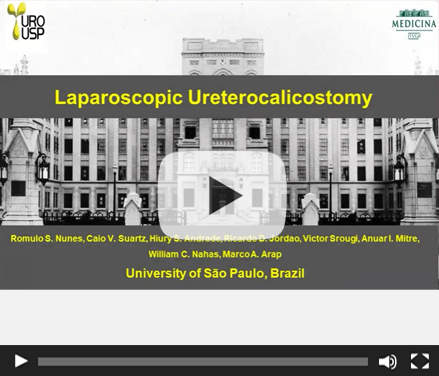 Laparoscopic Ureterocalicostomy Technique