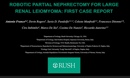 Robotic partial nephrectomy for large renal Leiomyoma: first case report