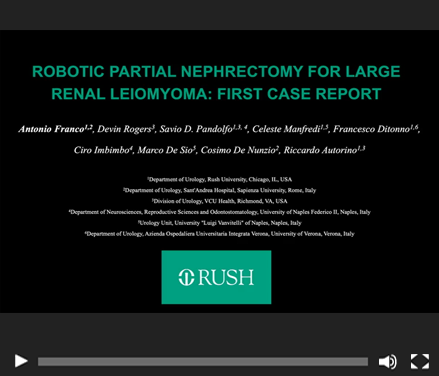 Robotic partial nephrectomy for large renal Leiomyoma: first case report