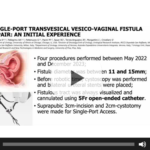 Single-Port Transvesical Vesico-Vaginal Fistula Repair: An Initial Experience