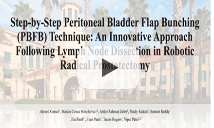 Step-by-step Peritoneal Bladder Flap Bunching (PBFB) technique: an innovative approach following lymph node dissection in robotic radical prostatectomy