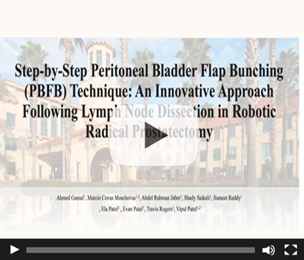 Step-by-step Peritoneal Bladder Flap Bunching (PBFB) technique: an innovative approach following lymph node dissection in robotic radical prostatectomy