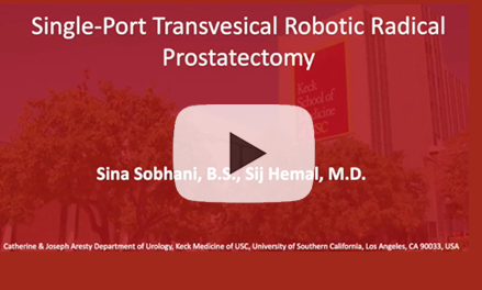 Single-Port Transvesical Robotic Radical Prostatectomy in a Patient with Hostile Abdomen