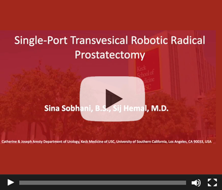 Single-Port Transvesical Robotic Radical Prostatectomy in a Patient with Hostile Abdomen