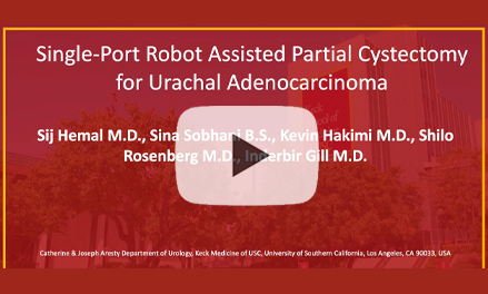 Single-Port Robot assisted partial cystectomy for urachal adenocarcinoma