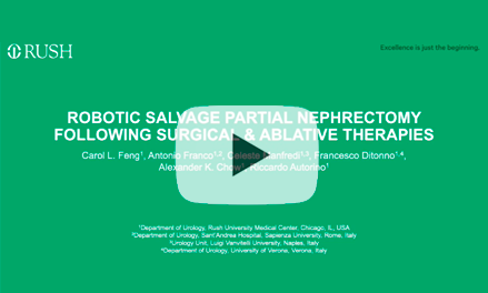 Single Port Robotic Nephrectomy via lower anterior retroperitoneal approach: feasible, safe and effective option in surgically complex patients