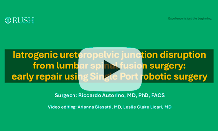 Iatrogenic Ureteropelvic Junction Disruption from Lumbar Spinal Fusion Surgery: Early Repair using The SP Robotic System