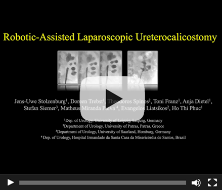 Robotic-assisted Laparoscopic Ureterocalicostomy (RALUC): How we do it