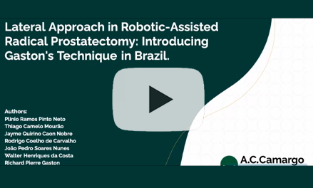 Lateral Approach in Robotic-Assisted Radical Prostatectomy: Introducing Gaston’s Technique in Brazil