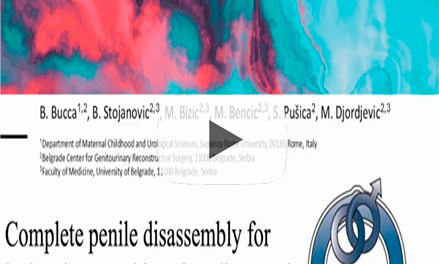 Complete penile disassembly for isolated penopubic epispadias repair: The “Belgrade approach”