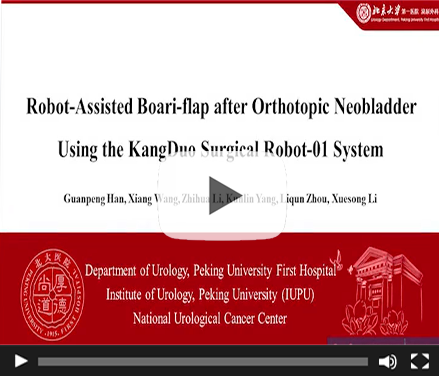 Robot-Assisted Boari-flap after Orthotopic Neobladder Using the KangDuo Surgical Robot-01 System