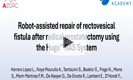 Robot-assisted Repair of Rectovesical Fistula after Radical Prostatectomy using the Hugo™ RAS System