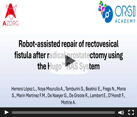 Robot-assisted Repair of Rectovesical Fistula after Radical Prostatectomy using the Hugo™ RAS System