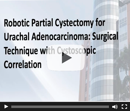 Robotic Partial Cystectomy for Urachal Adenocarcinoma: Surgical Technique with Cystoscopic Correlation