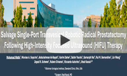 Salvage Single-Port Transvesical Robotic Radical Prostatectomy Following High-Intensity Focused Ultrasound (HIFU) Therapy