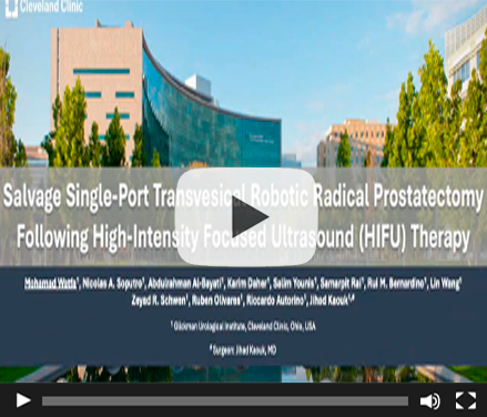 Salvage Single-Port Transvesical Robotic Radical Prostatectomy Following High-Intensity Focused Ultrasound (HIFU) Therapy