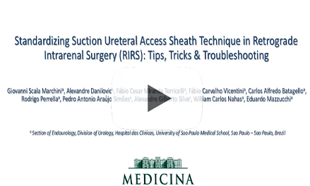 Standardizing Suction Ureteral Access Sheath Technique in Retrograde Intrarenal Surgery (RIRS): Tips, Tricks & Troubleshooting