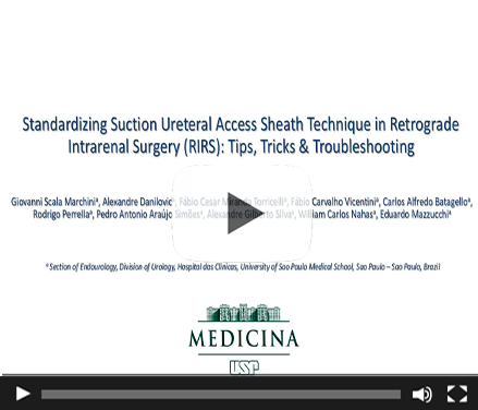 Standardizing Suction Ureteral Access Sheath Technique in Retrograde Intrarenal Surgery (RIRS): Tips, Tricks & Troubleshooting